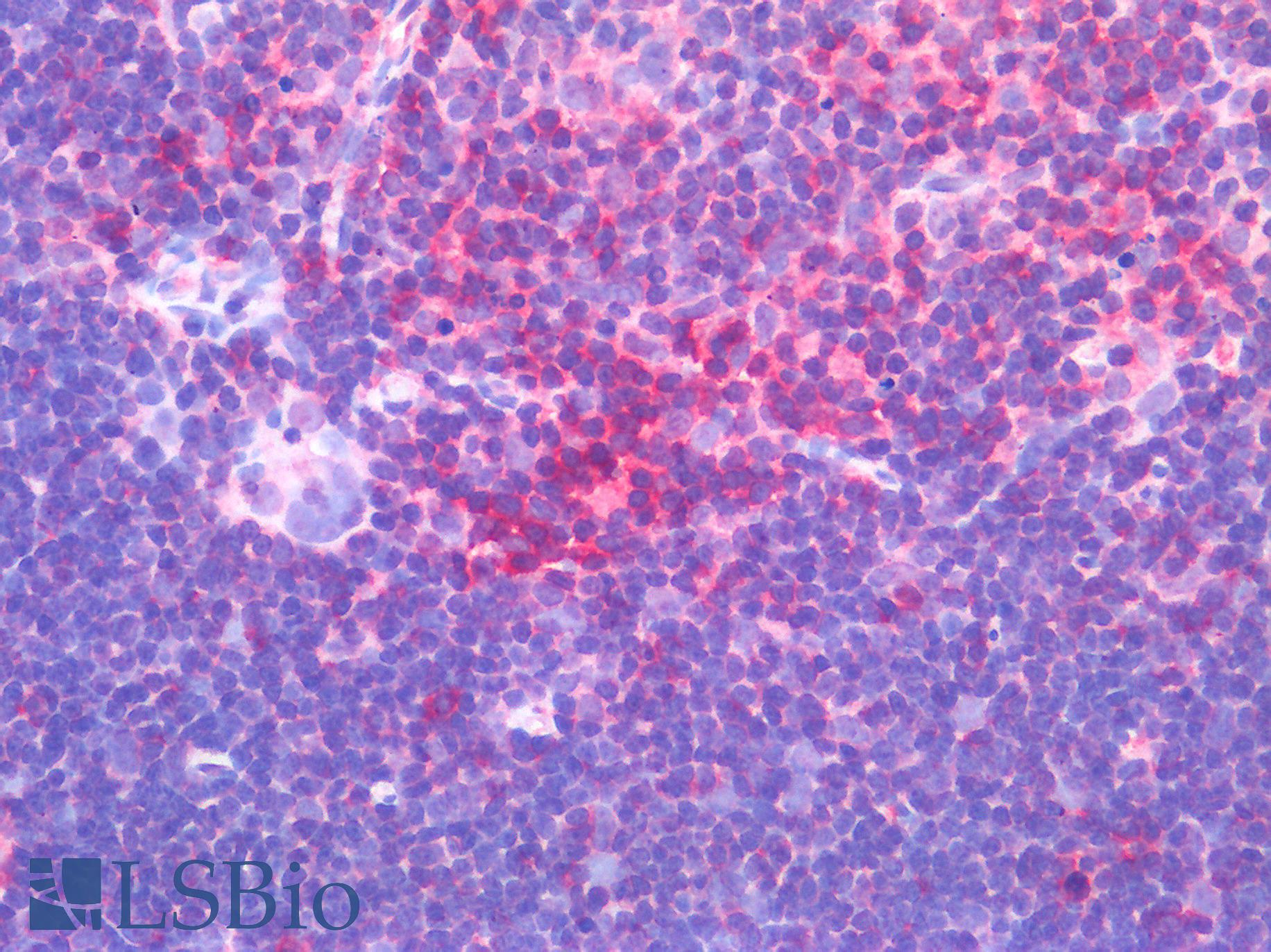 CD45 / LCA Antibody - Human Thymus: Formalin-Fixed, Paraffin-Embedded (FFPE)