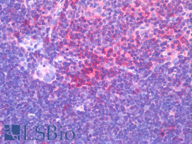 CD45 / LCA Antibody - Human Thymus: Formalin-Fixed, Paraffin-Embedded (FFPE)