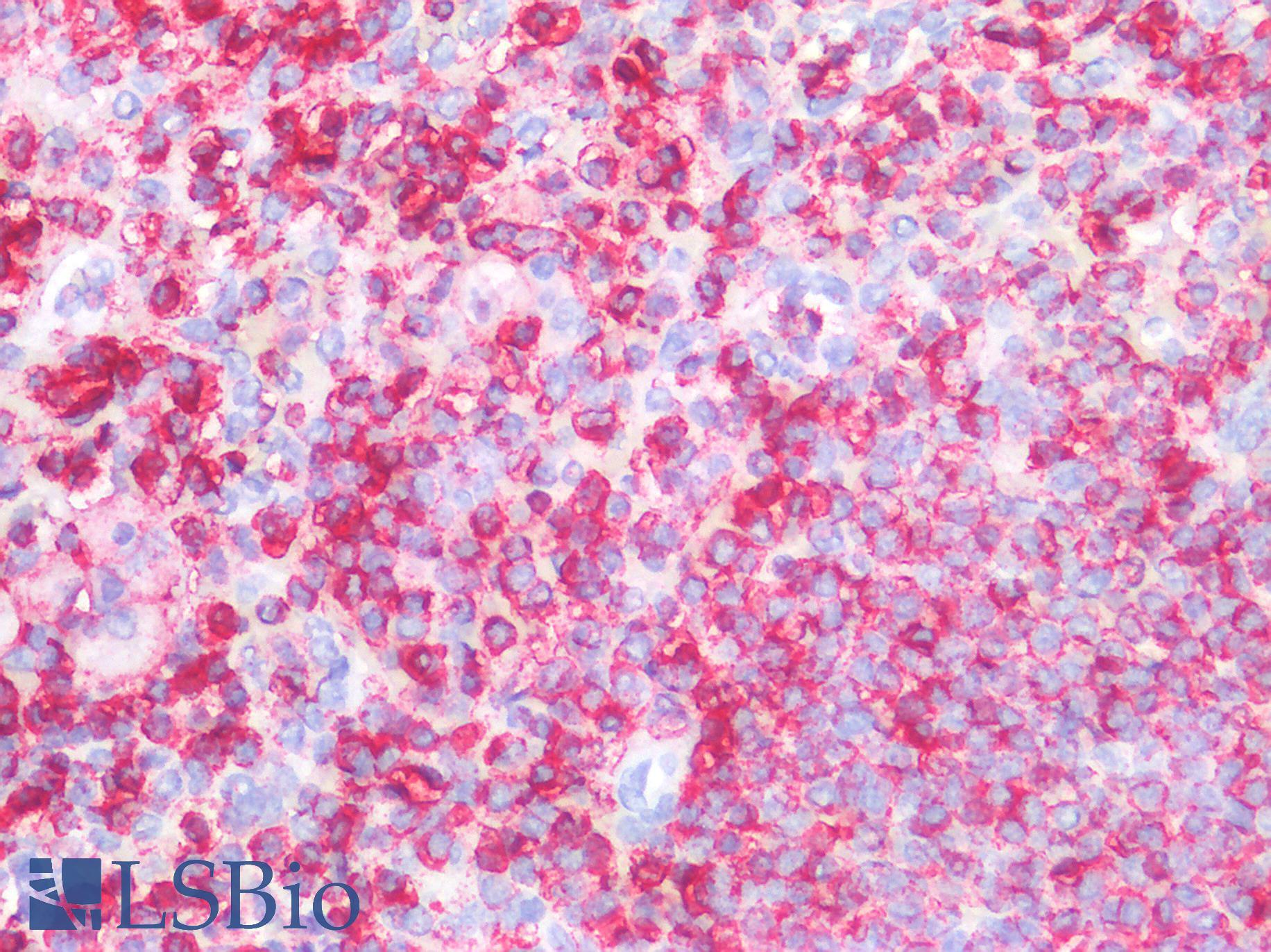 CD45 / LCA Antibody - Human Spleen: Formalin-Fixed, Paraffin-Embedded (FFPE)