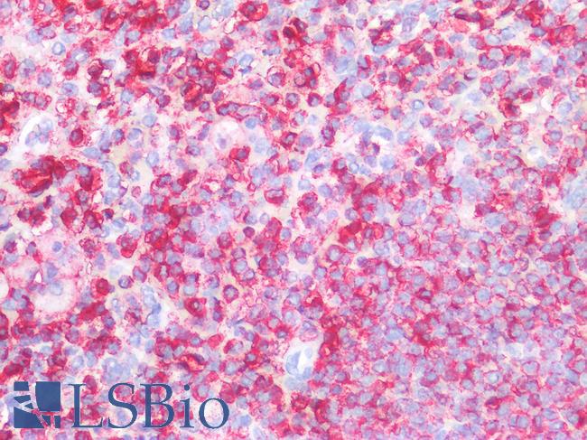 CD45 / LCA Antibody - Human Spleen: Formalin-Fixed, Paraffin-Embedded (FFPE)