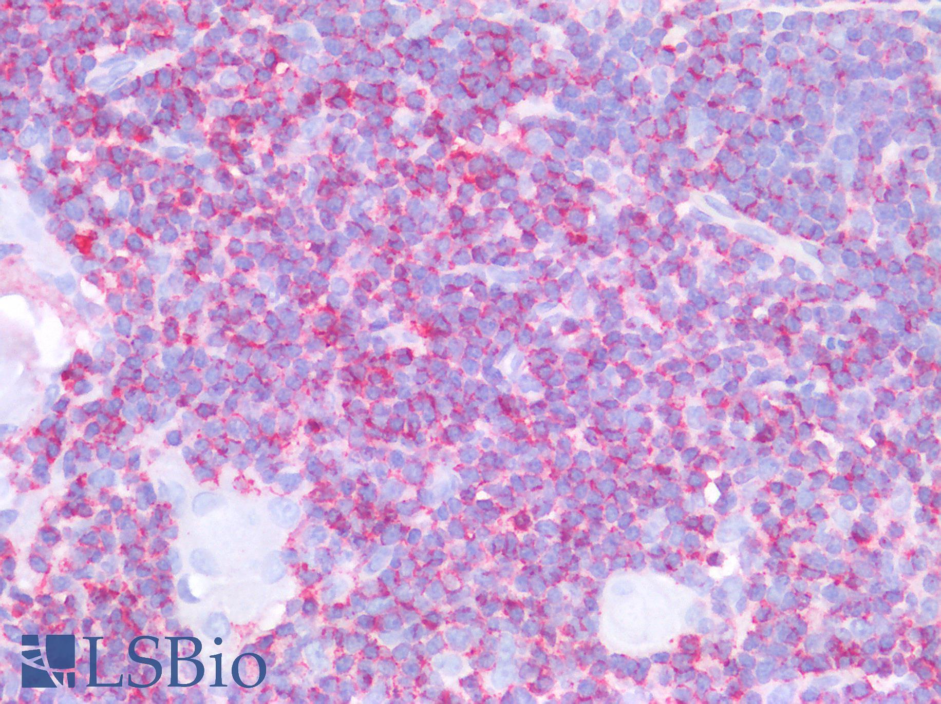 CD45 / LCA Antibody - Human Thymus: Formalin-Fixed, Paraffin-Embedded (FFPE)