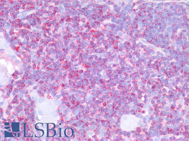 CD45 / LCA Antibody - Human Thymus: Formalin-Fixed, Paraffin-Embedded (FFPE)