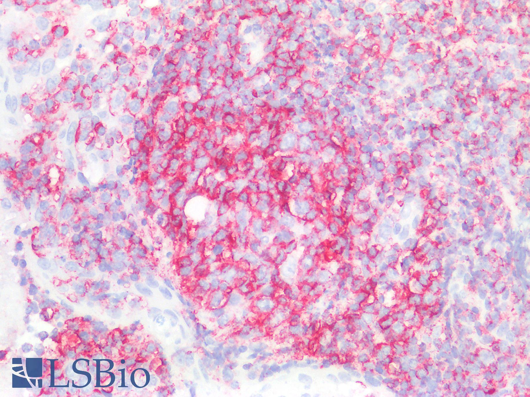 CD45 / LCA Antibody - Human Tonsil: Formalin-Fixed, Paraffin-Embedded (FFPE)