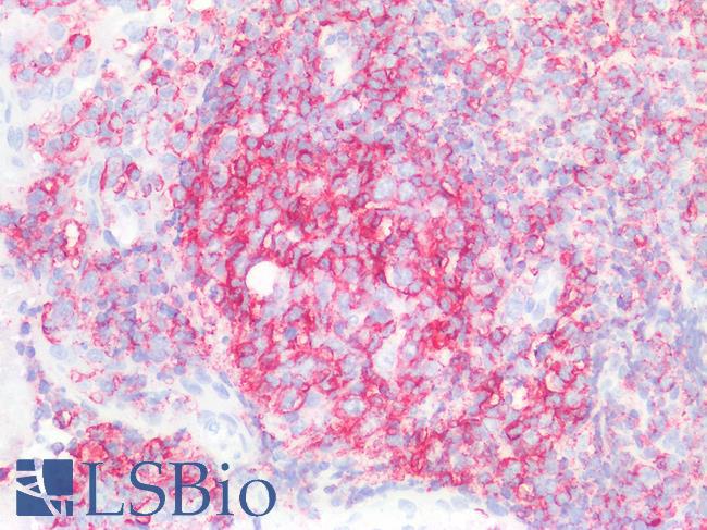 CD45 / LCA Antibody - Human Tonsil: Formalin-Fixed, Paraffin-Embedded (FFPE)