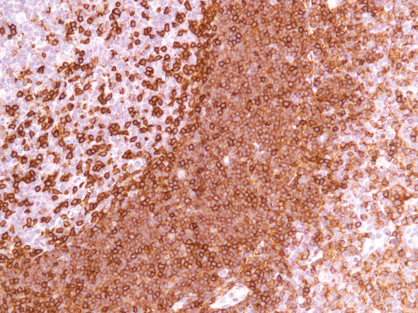 CD45R Antibody - CD45R on Tonsil