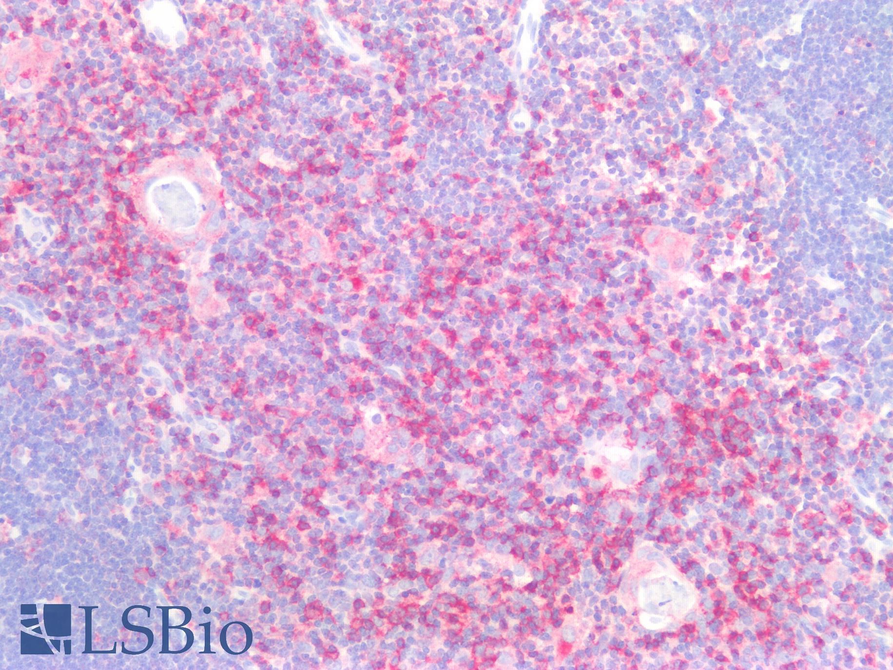 CD45R Antibody - Human Thymus: Formalin-Fixed, Paraffin-Embedded (FFPE)