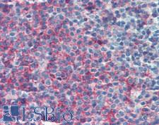 CD45RA Antibody - Human Spleen: Formalin-Fixed, Paraffin-Embedded (FFPE)