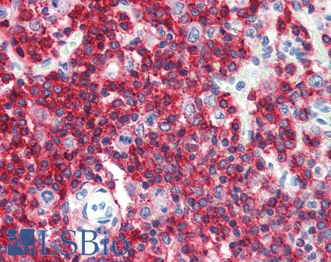 CD45RA Antibody - Anti-CD45RA antibody IHC of human spleen. Immunohistochemistry of formalin-fixed, paraffin-embedded tissue after heat-induced antigen retrieval. Antibody dilution 1:50. This image was taken for the unconjugated form of this product. Other forms have not been tested.