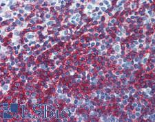 CD45RB Antibody - Human Small Intestine, MALT: Formalin-Fixed, Paraffin-Embedded (FFPE)