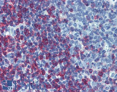 CD45RB Antibody - Human Tonsil: Formalin-Fixed, Paraffin-Embedded (FFPE)