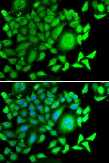 CD47 Antibody - Immunofluorescence analysis of MCF7 cell using CD47 antibody. Blue: DAPI for nuclear staining.