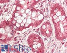 CD47 Antibody - Human Small Intestine: Formalin-Fixed, Paraffin-Embedded (FFPE)