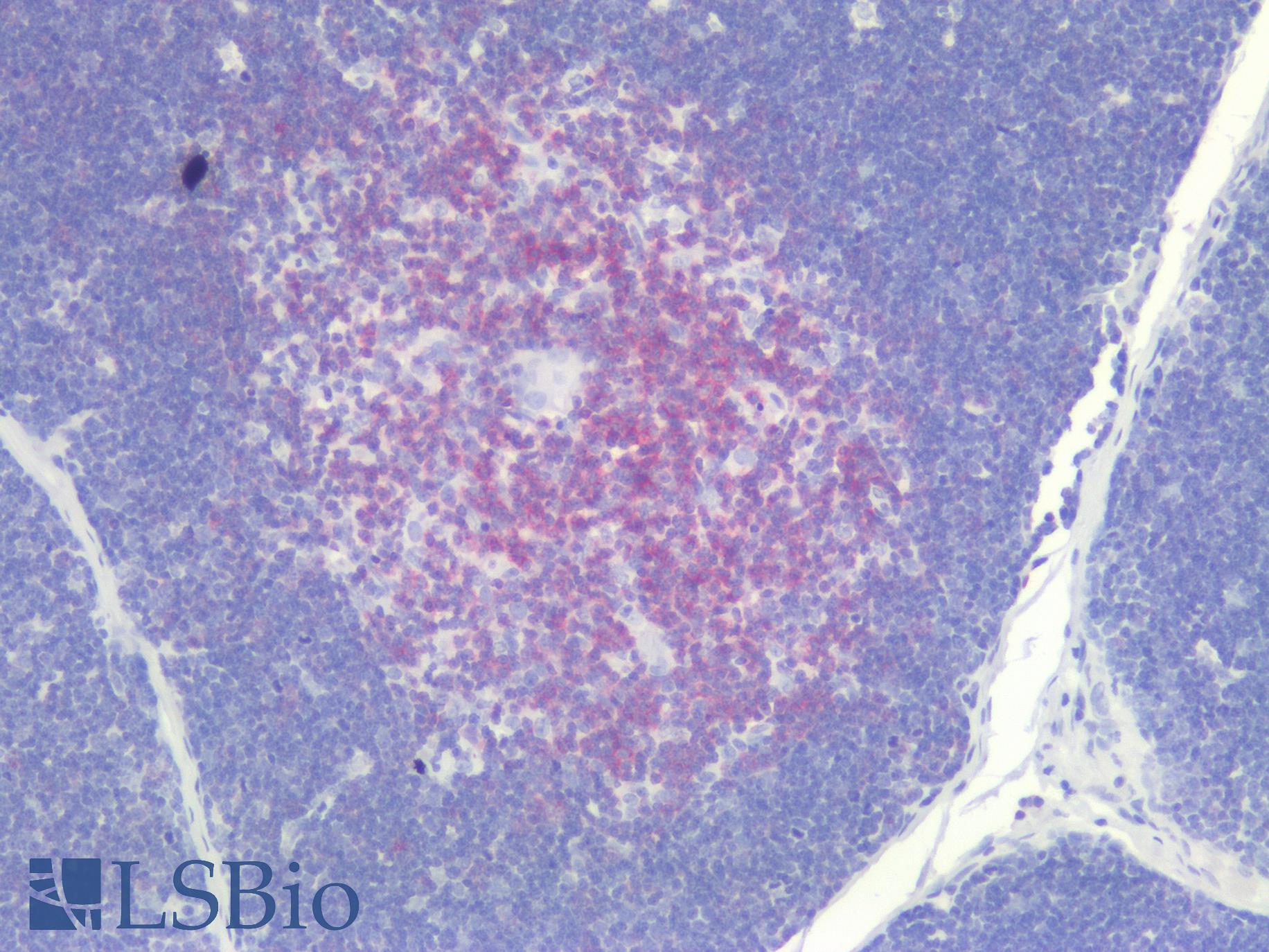 CD5 Antibody - Human Thymus: Formalin-Fixed, Paraffin-Embedded (FFPE)