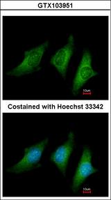CD55 Antibody - Immunofluorescence of methanol-fixed HeLa using CD55 antibody at 1:200 dilution.