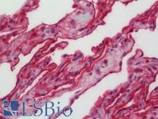 CD55 Antibody - Human Lung: Formalin-Fixed, Paraffin-Embedded (FFPE)
