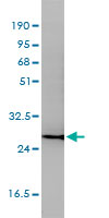 CD58 Antibody - CD58 monoclonal antibody (M01), clone 2D11-B10 Western blot of CD58 expression in Jurkat.