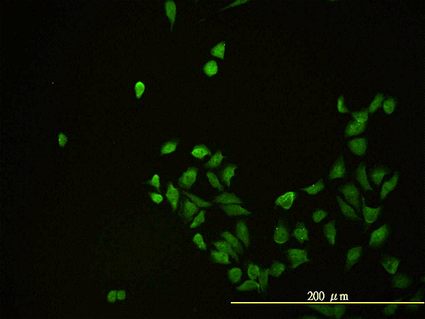 CD58 Antibody - Immunofluorescence of monoclonal antibody to CD58 on HeLa cell. [antibody concentration 10 ug/ml]
