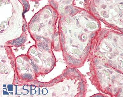 CD59 Antibody - Human Placenta: Formalin-Fixed, Paraffin-Embedded (FFPE)