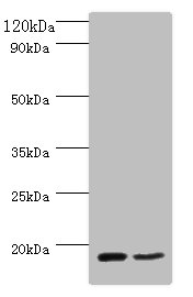 CD59 Antibody - All lanes: Eukaryotic translation initiation factor 4E-binding protein 2 antibody at 2ug/ml Lane 1 : mouse heart tissue Lane 2 : NIH3T3 whole cell lysate Secondary Goat polyclonal to Rabbit IgG at 1/10000 dilution Predicted band size: 13kDa Observed band size: 13kDa