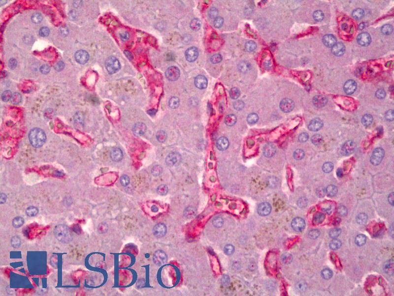 CD59 Antibody - Anti-CD59 antibody IHC of human liver. Immunohistochemistry of formalin-fixed, paraffin-embedded tissue after heat-induced antigen retrieval. Antibody dilution 1:50. This image was taken for the unconjugated form of this product. Other forms have not been tested.