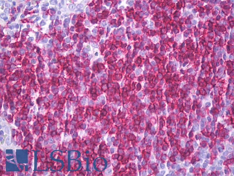 CD6 Antibody - Anti-CD6 antibody IHC of human tonsil. Immunohistochemistry of formalin-fixed, paraffin-embedded tissue after heat-induced antigen retrieval. Antibody concentration 10 ug/ml.  This image was taken for the unconjugated form of this product. Other forms have not been tested.