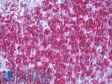 CD6 Antibody - Anti-CD6 antibody IHC of human tonsil. Immunohistochemistry of formalin-fixed, paraffin-embedded tissue after heat-induced antigen retrieval. Antibody concentration 10 ug/ml.  This image was taken for the unconjugated form of this product. Other forms have not been tested.