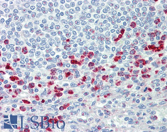 CD63 Antibody - Anti-CD63 antibody IHC staining of human spleen. Immunohistochemistry of formalin-fixed, paraffin-embedded tissue after heat-induced antigen retrieval.