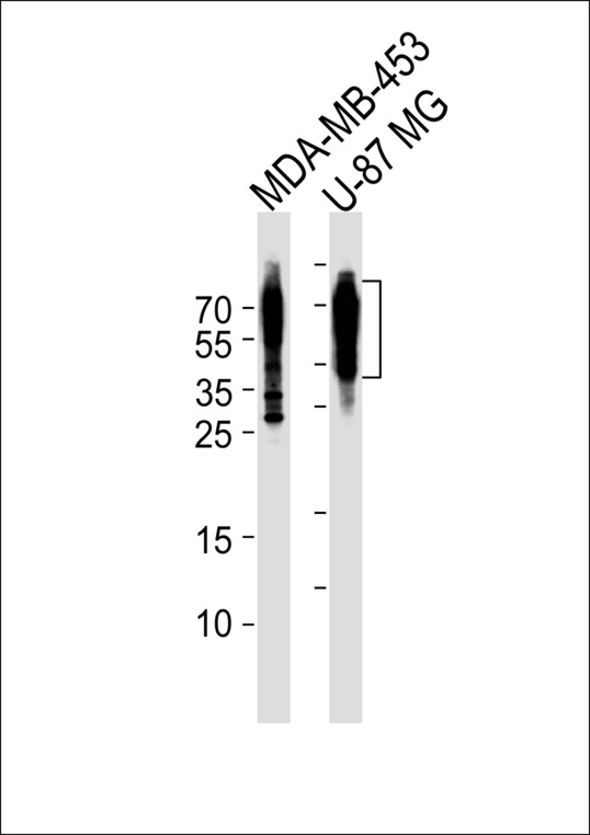 CD63 Antibody - Western blot of lysates from MDA-MB-453, U-87 MG cell line (from left to right), using CD63 Antibody. Antibody was diluted at 1:1000 at each lane. A goat anti-rabbit IgG H&L (HRP) at 1:5000 dilution was used as the secondary antibody. Lysates at 35ug per lane.