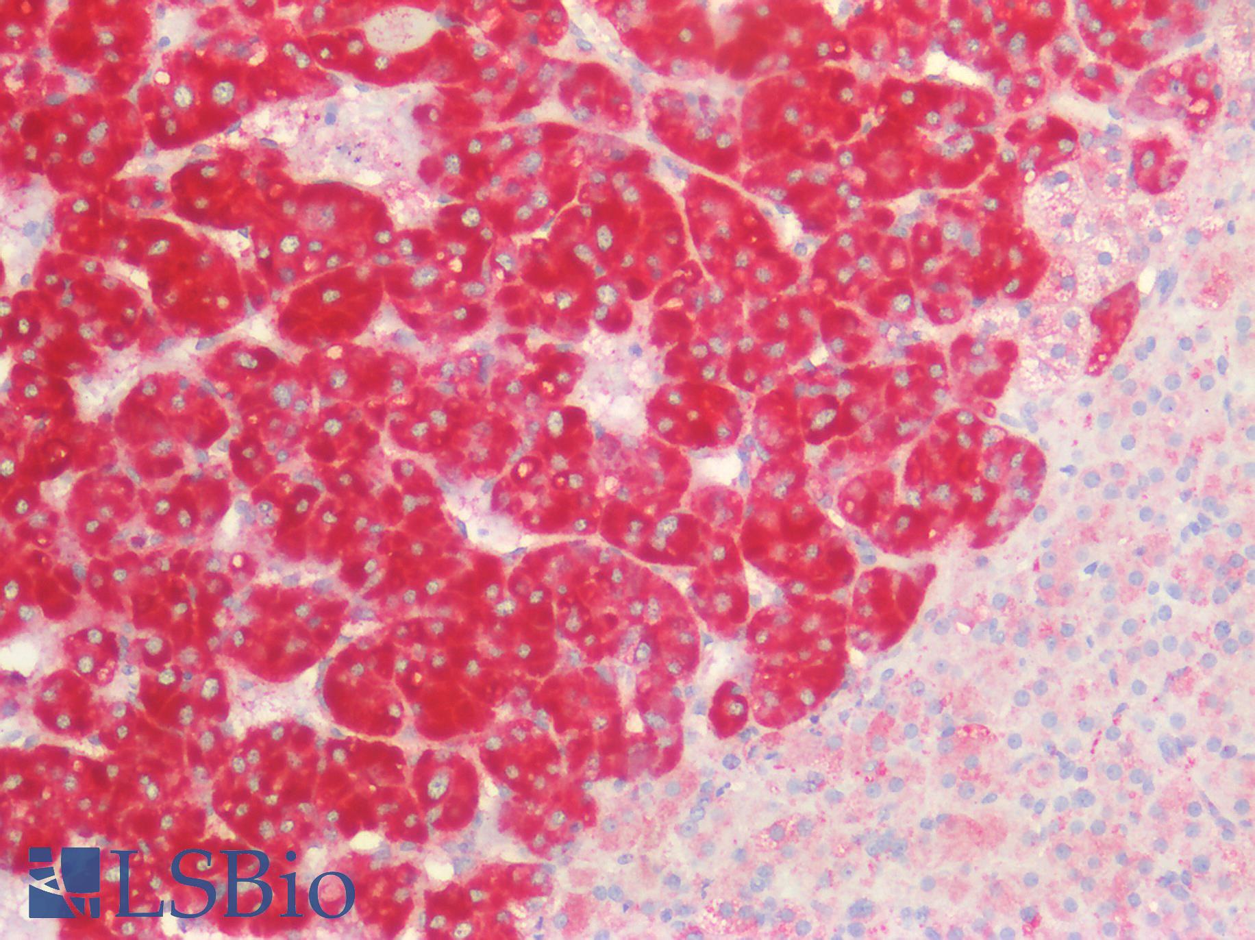 CD63 Antibody - Human Adrenal: Formalin-Fixed, Paraffin-Embedded (FFPE)