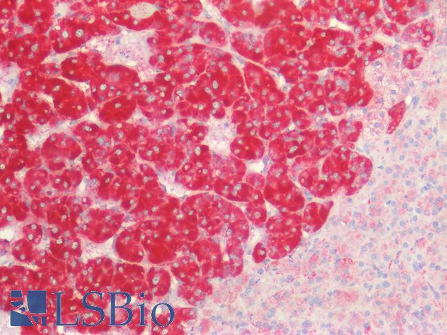 CD63 Antibody - Human Adrenal: Formalin-Fixed, Paraffin-Embedded (FFPE)