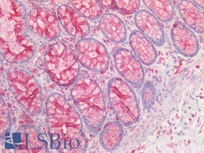 CD63 Antibody - Human Colon: Formalin-Fixed, Paraffin-Embedded (FFPE)