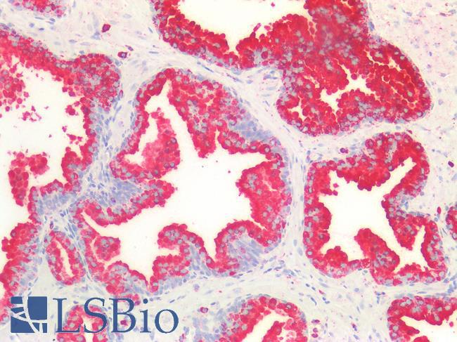 CD63 Antibody - Human Prostate: Formalin-Fixed, Paraffin-Embedded (FFPE)