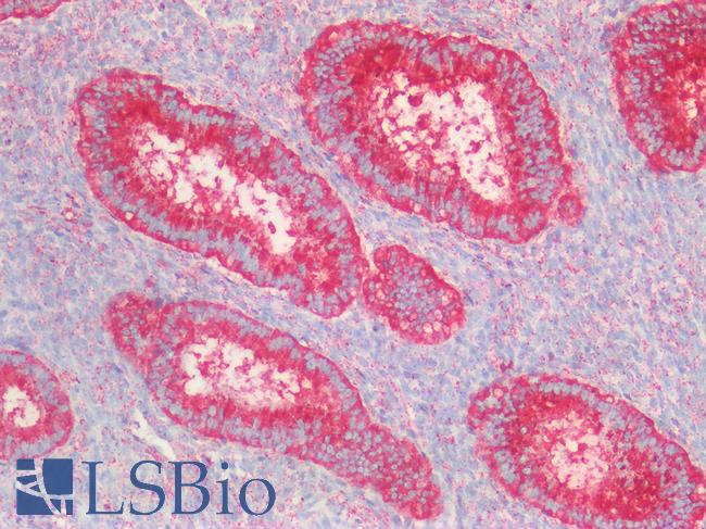 CD63 Antibody - Human Uterus: Formalin-Fixed, Paraffin-Embedded (FFPE)