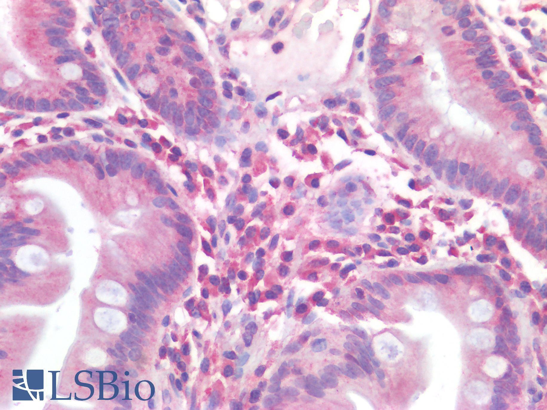 CD63 Antibody - Human Small Intestine: Formalin-Fixed, Paraffin-Embedded (FFPE)