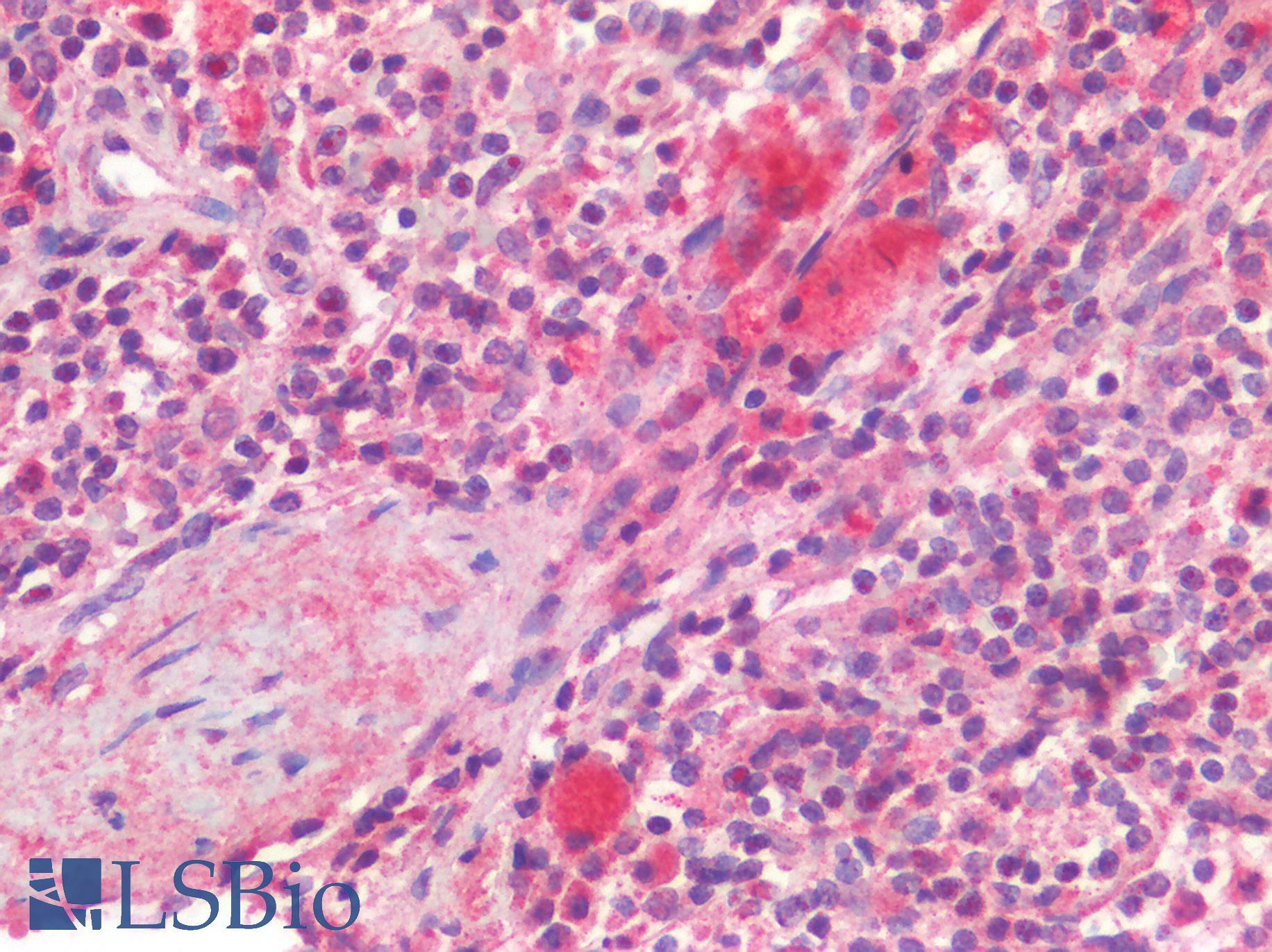 CD63 Antibody - Human Spleen: Formalin-Fixed, Paraffin-Embedded (FFPE)