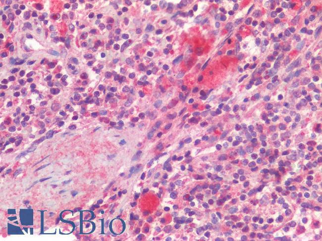 CD63 Antibody - Human Spleen: Formalin-Fixed, Paraffin-Embedded (FFPE)