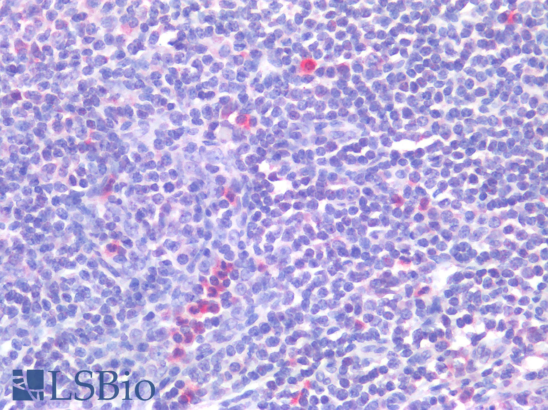 CD63 Antibody - Human Spleen: Formalin-Fixed, Paraffin-Embedded (FFPE)