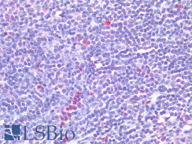 CD63 Antibody - Human Spleen: Formalin-Fixed, Paraffin-Embedded (FFPE)