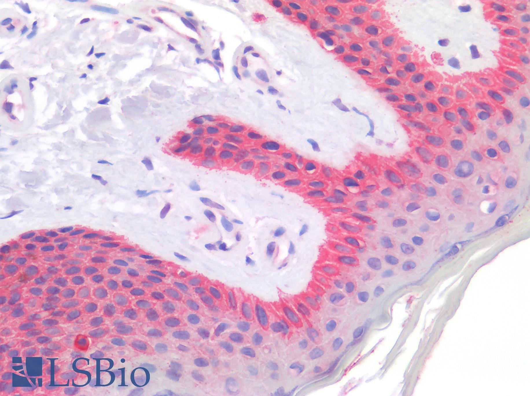 CD63 Antibody - Human Skin: Formalin-Fixed, Paraffin-Embedded (FFPE)