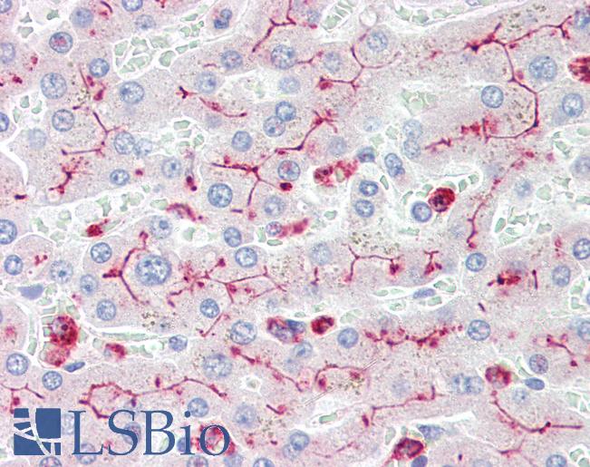 CD66acd Antibody - Anti-CD66acd antibody IHC of human liver. Immunohistochemistry of formalin-fixed, paraffin-embedded tissue after heat-induced antigen retrieval. Antibody concentration 10 ug/ml.