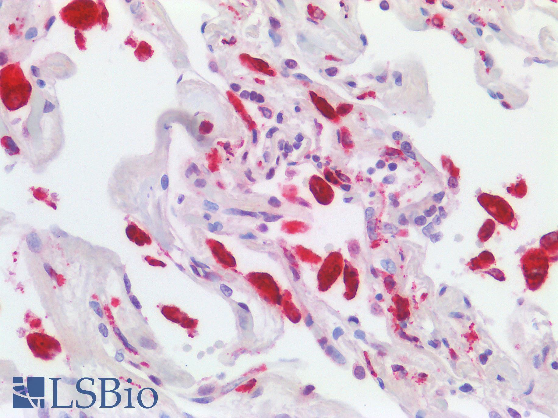 CD68 Antibody - Human Lung: Formalin-Fixed, Paraffin-Embedded (FFPE)