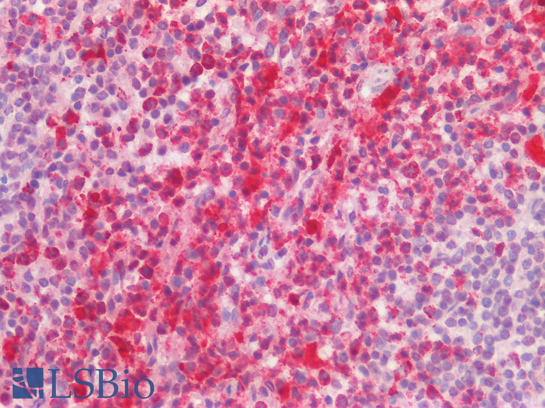 CD68 Antibody - Human Spleen: Formalin-Fixed, Paraffin-Embedded (FFPE)