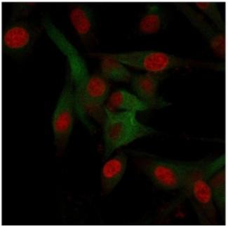 CD68 Antibody - Immunofluorescent staining of fixed human U-87 MG cells with CD68 antibody (clone C68/684, green) and Reddot nuclear stain (red).