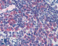 CD69 Antibody - Anti-CD69 antibody IHC of mouse spleen. Immunohistochemistry of formalin-fixed, paraffin-embedded tissue after heat-induced antigen retrieval. Antibody concentration 10 ug/ml. This image was taken for the unconjugated form of this product. Other forms have not been tested.