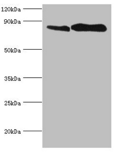CD71 / Transferrin Receptor Antibody - Western blot All lanes: Transferrin receptor protein 1 antibody at 2µg/ml Lane 1: U251 whole cell lysate Lane 2: 293T whole cell lysate Secondary Goat polyclonal to rabbit IgG at 1/10000 dilution Predicted band size: 85 kDa Observed band size: 85 kDa
