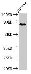 CD71 / Transferrin Receptor Antibody - Western Blot Positive WB detected in: Jurkat whole cell lysate All lanes: TFRC antibody at 3µg/ml Secondary Goat polyclonal to rabbit IgG at 1/50000 dilution Predicted band size: 85 kDa Observed band size: 85 kDa