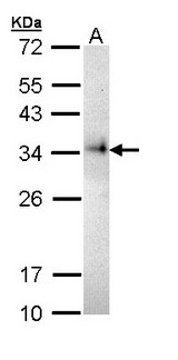 CD74 / CLIP Antibody - Sample (30 ug of whole cell lysate). A: Raji. 12% SDS PAGE. CD74 antibody diluted at 1:5000.