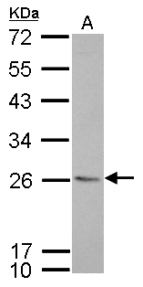 CD74 / CLIP Antibody - CD74 antibody [N1N2], N-term detects CD74 protein by Western blot analysis. A. 30 ug GL261 whole cell lysate/extract. 12 % SDS-PAGE. CD74 antibody [N1N2], N-term dilution:1:1000