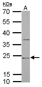 CD74 / CLIP Antibody - CD74 antibody [N1N2], N-term detects CD74 protein by Western blot analysis. A. 30 ug Rat2 whole cell lysate/extract. 12 % SDS-PAGE. CD74 antibody [N1N2], N-term dilution:1:1000