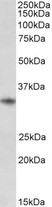 CD74 / CLIP Antibody - Antibody (0.01µg/ml) staining of Human Tonsil lysate (35µg protein in RIPA buffer). Primary incubation was 1 hour. Detected by chemiluminescence.